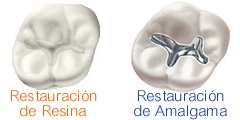 Operatoria y Estética Dental (Calzas):