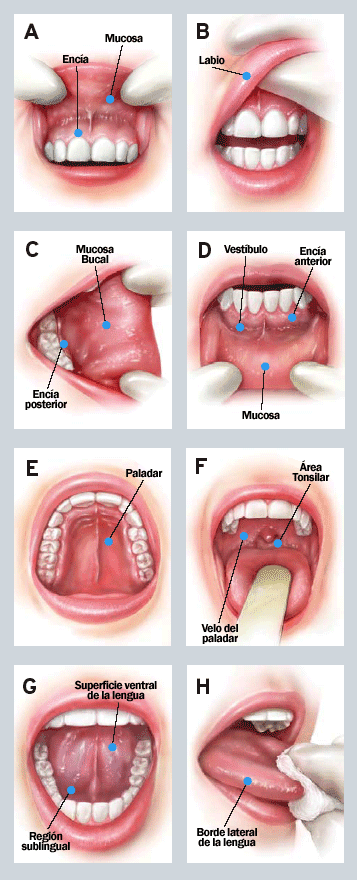 Oral self-examination to prevent Oral Cancer.